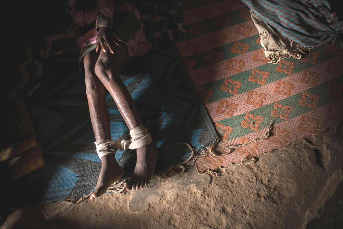 Shackling of women in the name of mental health