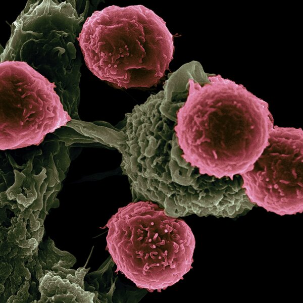 Cancer in sub-Saharan Africa