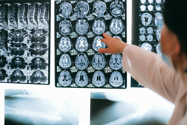 11 million lives lost each year: urgent action needed on neurological care