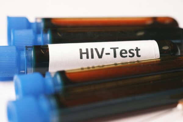Unaids warnt vor Einschnitten bei HIV-Programmen