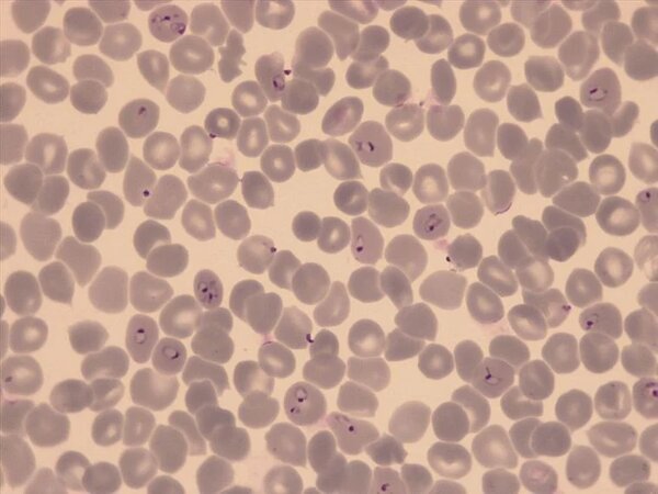 Researchers Develop a New Drug Candidate to Tackle Resistant Malaria Strains