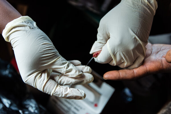 HIV Test-and-Treat: Are the 90 - 90 - 90 targets set for 2020 within reach?