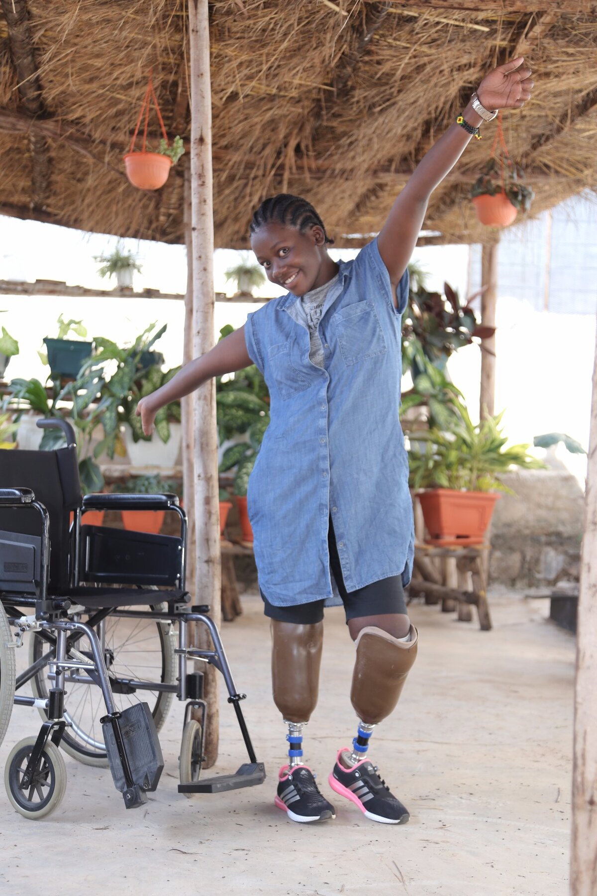 Asia, 20 ans, de Mwanza, Tanzanie : amput&eacute;e bilat&eacute;rale sans 9 doigts, avec ses nouvelles proth&egrave;ses. Photo : &copy; SwissLimbs