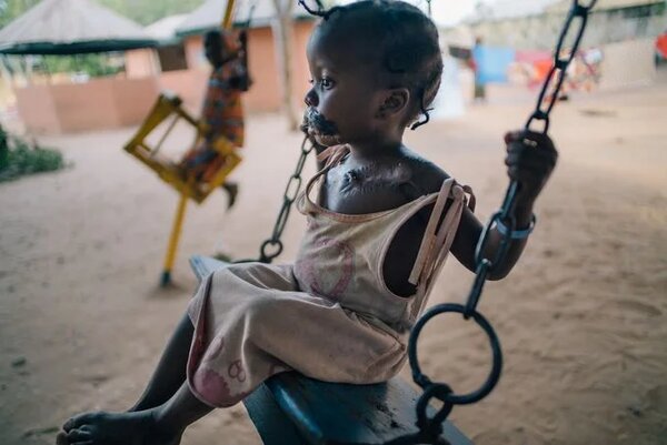 New Publication Sets Global Research Priorities to End Noma
