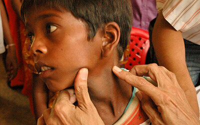 Wege zur endgültigen Eliminierung von Lepra