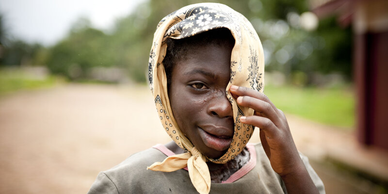 Stigma - a special Problem of NTDs